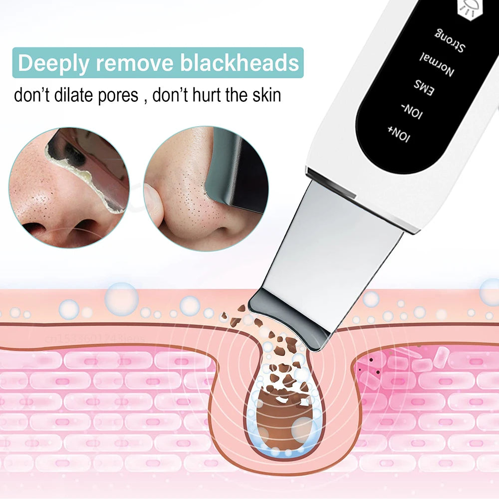 Skin Scrubber Peeling Blackhead Remover - Glowify Essentials